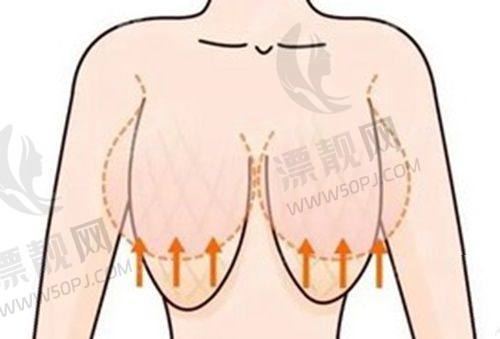 三、疤痕植发专项推荐