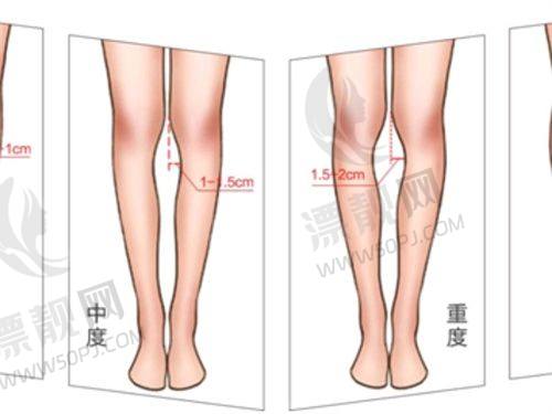 贴心建议
