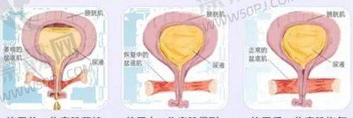 合肥比较好的植发机构排行榜最新：合肥维多利亚、雍禾、新生植发强势上榜！