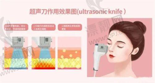 特色技术:多样技术满足不同需求
