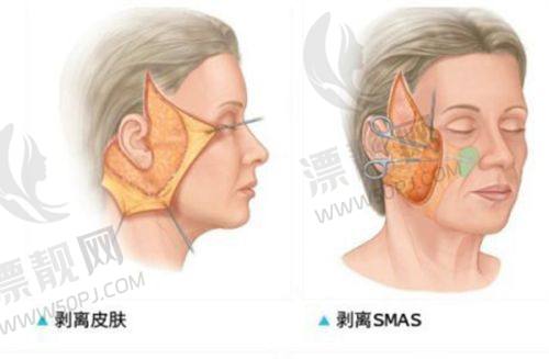 满足你的医美需求,就选北京叶子整形医院