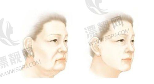 深圳隆胸整形医院排名前十及价格揭秘！曹孟君、艺星、美莱领衔2025权威榜单