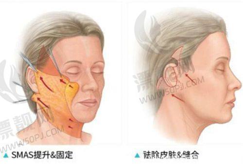 深圳整形医院前十排行榜！深圳医疗美容医院、鹏程、美莱各有啥特色？