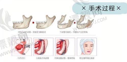 芜湖伊莱美未来展望:持续为美丽助力