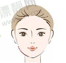 附加服务费用——保护手术顺利进行