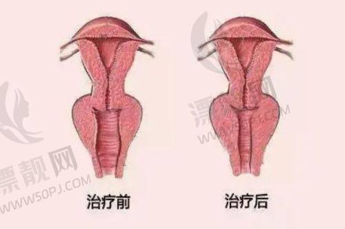 解密杨氏切缝的五大技术突破