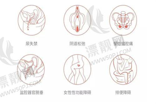 选择建议