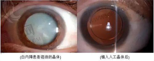 4. 成都碧莲盛植发