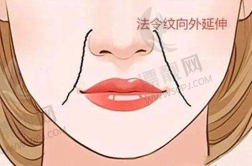 选择建议
