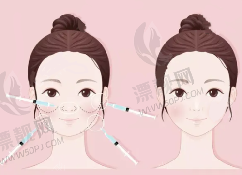 术后护理:把修复期变成