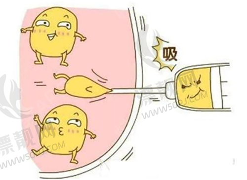 三、选择建议