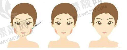 四、维权保护:贴心守护,让美丽没有后顾之忧