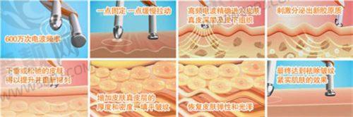 鼻部整形项目