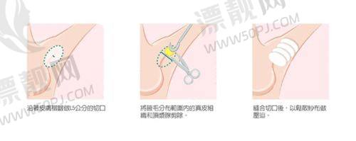 Top4:长沙长海医院(私密修复中 心)