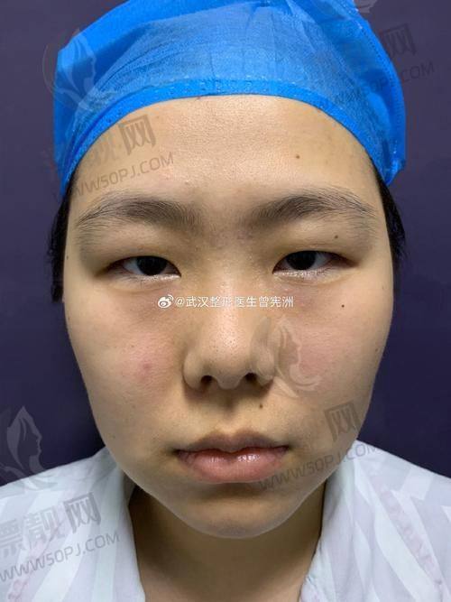 适不适合我？这几种情况尤其推荐试试