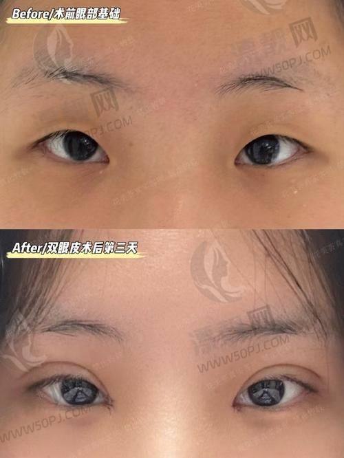 上海王洪医生整形资质正规，是有实力的好医生专注馒化脸等问题诊疗