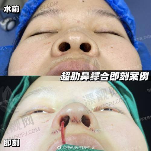 SEO关键词内容拓展:济南海峡植发医院简介 医生 价格表 实例 地址