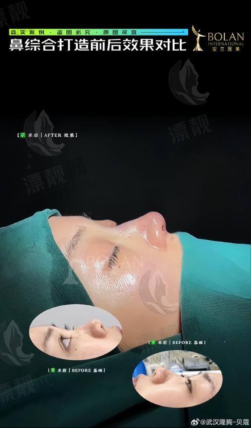 济南海峡植发价格表大公开 | 项目清晰透明,我来帮你算一算!
