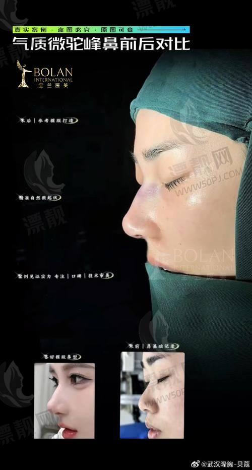 TOP1：西安艺星医疗美容医院