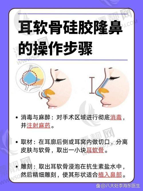 TOP5：西安美莱整形口腔医院