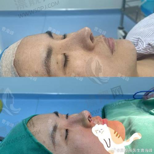 除了植发,还有这些附加服务值得点赞!