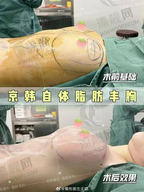 结语：塑形不是梦，关键在于选对“指挥官”