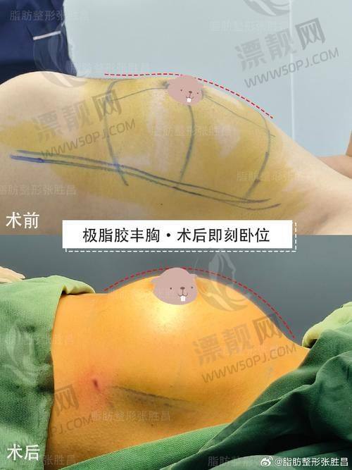 台州维多利亚医疗美容正规吗？挺正规的医院技术出色而且收费亲民性价比高
