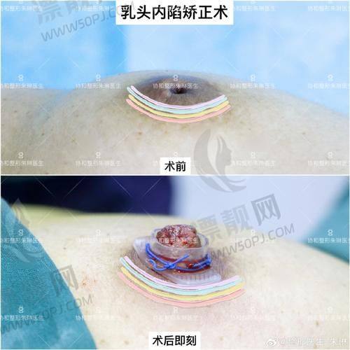 那么,台州维多利亚医疗美容正规吗?我给打分:靠谱+