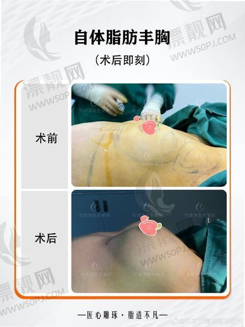 TOP4：西安高一生医疗美容医院