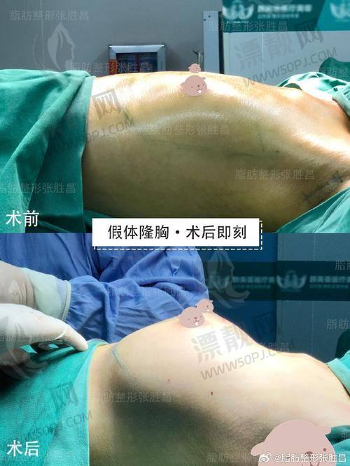 结语：如何选择适合你的南京注射医生？