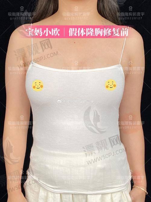 医生靠谱吗?经验+审美双在线
