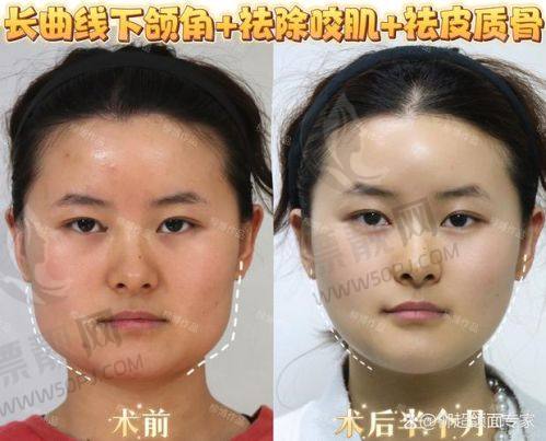 深圳八大处医院地址及交通路线详解