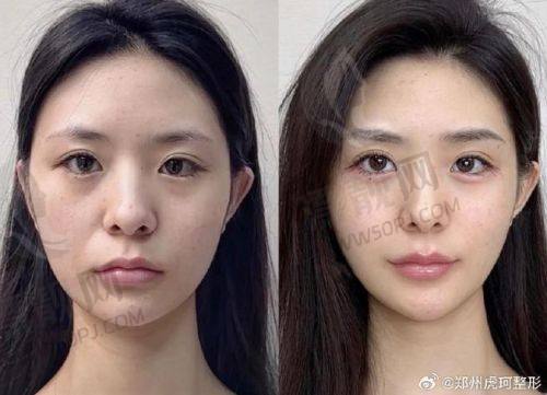 NO.3 淄博丽美整形医院