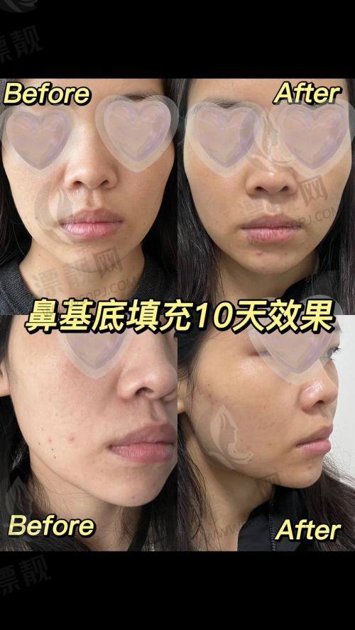 NO.1 淄博美冠臣整形医院