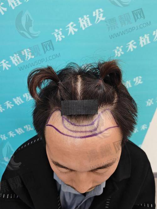 医生大揭秘:技术、审美和耐心,他们都在线