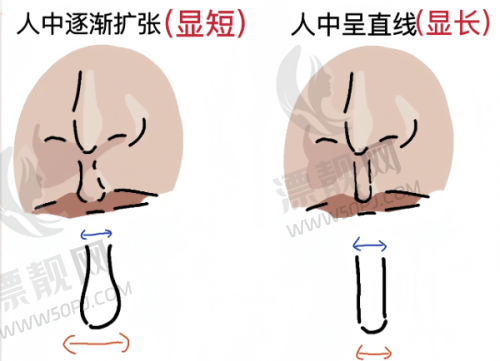润澜玻尿酸的安心性验证