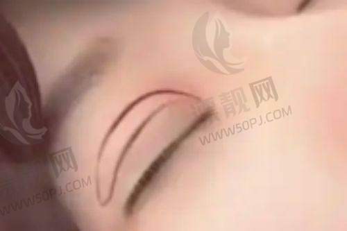 昆明昆大疤痕医院祛疤效果、正规性及收费情况大揭秘，治疗究竟好不好？