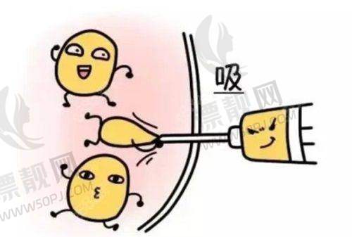 王棚：多维雕塑派脂肪艺术家，身体曲线调改小能手