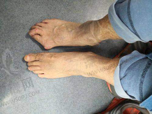 选择打紧缩针医院的实用小贴士