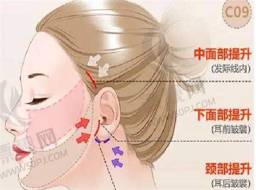 余文林和李精韬谁更好？唇腭裂修复专家对比，美学与功能如何选