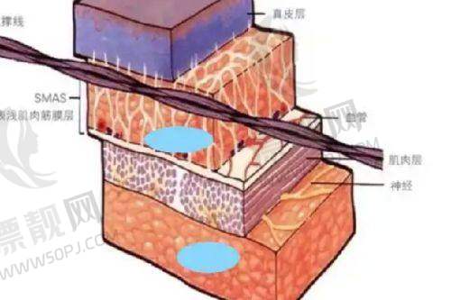 深圳美莱医疗美容医院收费详情大揭秘