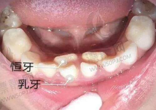 产品特点大比拼：不同的“武器”应对不同的头发问题