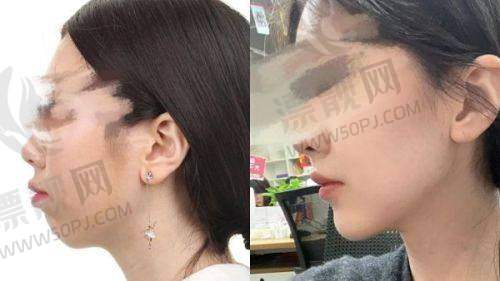 福州海峡整形美容医院的口碑与地址