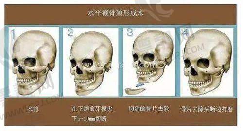 昆明昆大疤痕医院的医疗能力大比拼