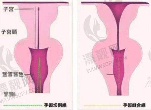 超强医生团队,技术实力杠杠的