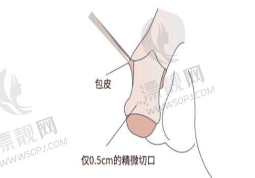 北京八大处疤痕修复科的患者口碑