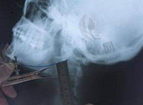 医生团队:经验多且专精