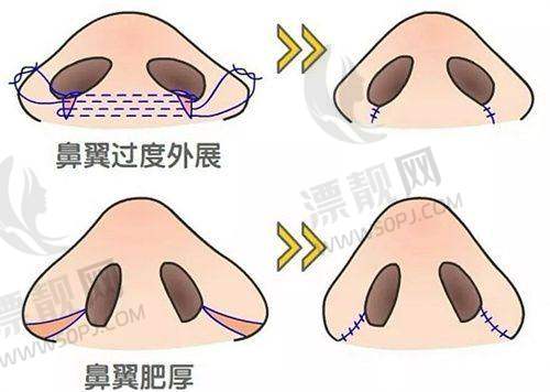 搭配使用与注意事项：让你的头发护理成效更佳