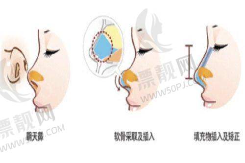 合肥壹加壹整形项目价格表详情