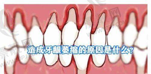 广州优雅联合口腔门诊价格参考